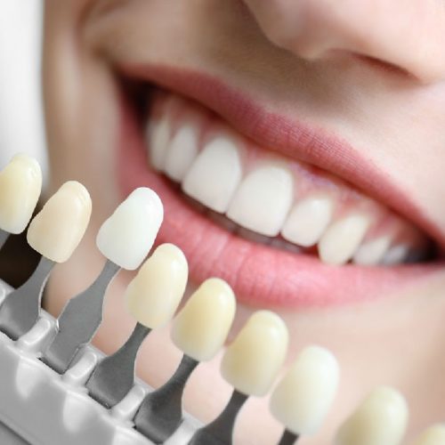 Signs That You Need to Make an Appointment with a Cosmetic Dentist