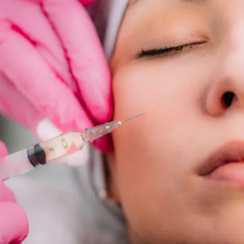 Dermal Filler in Singapore: Procedure, Benefits, and What to Expect