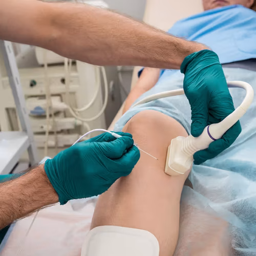 What You Should Know About Radiofrequency Ablation for Long-Term Pain