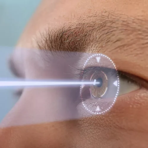 Everything You Need to Know About LASIK in Bangkok