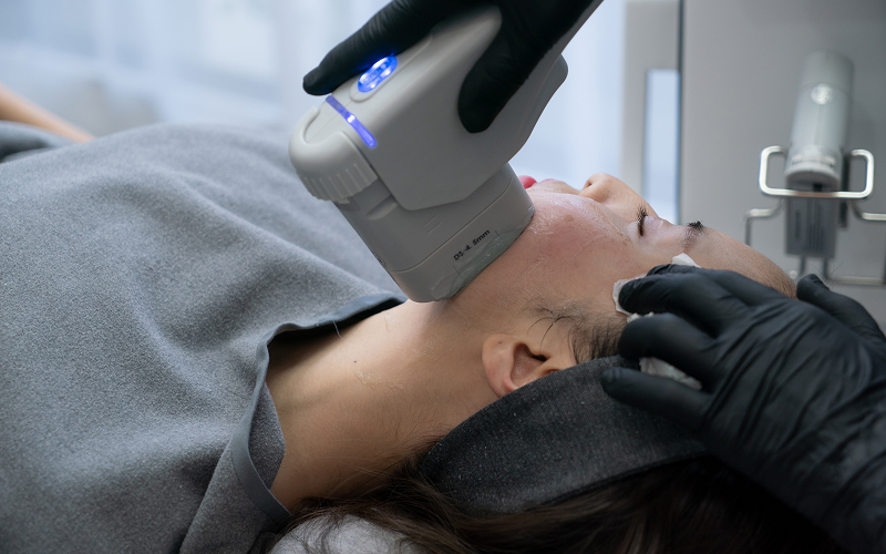 Comparing Chemical Peels, Lasers, and Medical Facials for Acne Scar Removal