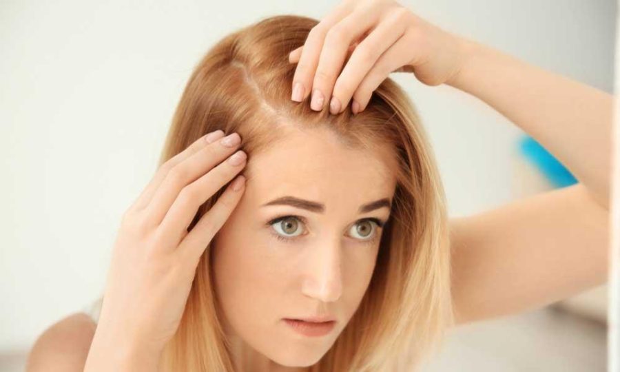 Preparing for a Hair Transplant | 8 Vital Steps