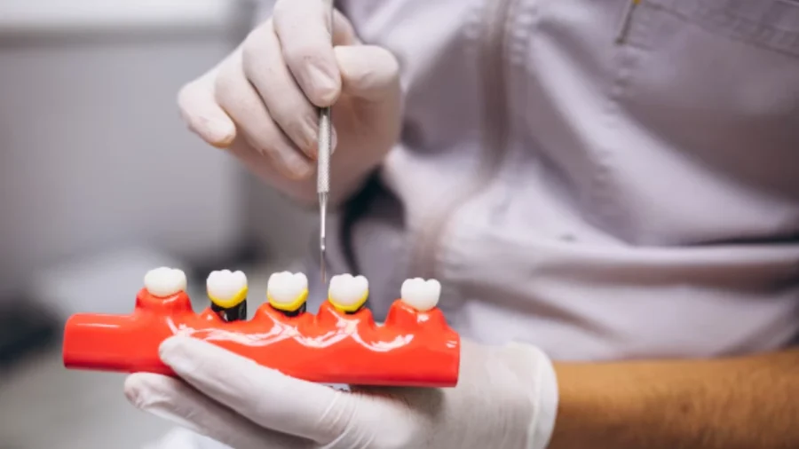 Redefining Dental Restorations with Aidite 3D Multilayer Zirconia