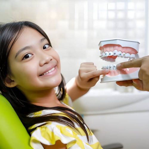 How to Recognize Misalignment in Your Child’s Smile