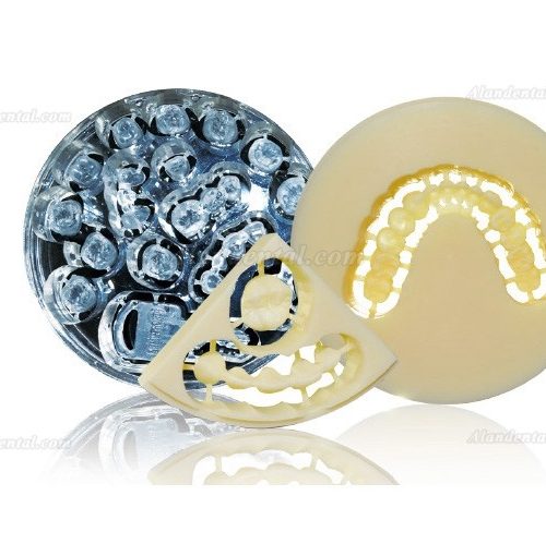 Temporary Crowns, Permanent Confidence: The Art of Aidite PMMA Multilayer Restorations